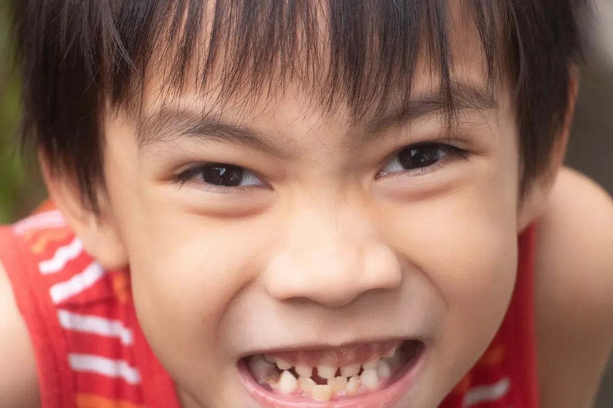 Close-up of a young child with a joyful expression in Baguio, Philippines, capturing pure happiness.